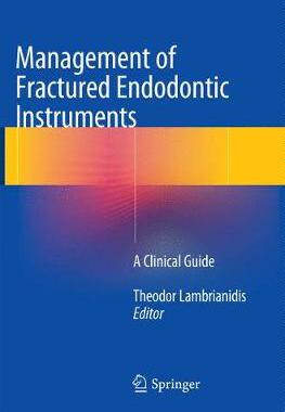 预订 Management of Fractured Endodontic Instruments