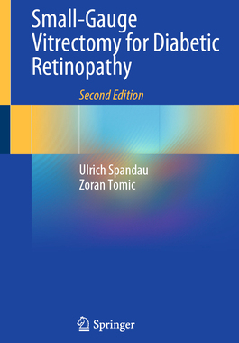 [预订]Small-Gauge Vitrectomy for Diabetic Retinopathy