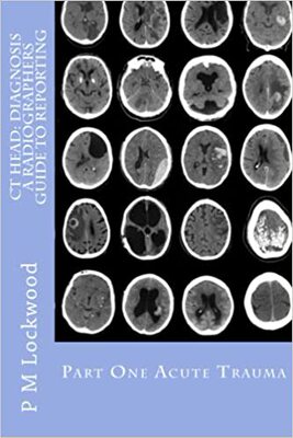 【预订】CT Head: DIAGNOSIS A Radiographers Guide To Reporting Part 1 Acute T 9781467923934