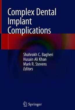 【预订】Complex Dental Implant Complications