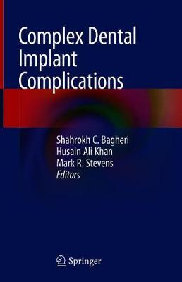 【预订】Complex Dental Implant Complications