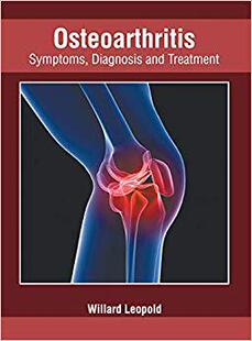 现货 Osteoarthritis: Symptoms, Diagnosis and Treatment