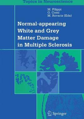 【预订】Normal-appearing White and Grey Matter Damage in Multiple Sclerosis