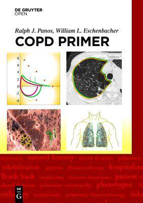 [预订]A COPD Primer 9783110467994