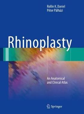 【预订】Rhinoplasty
