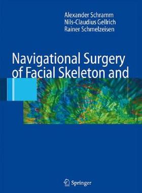 【预订】Navigational Surgery of the Facial Skeleton