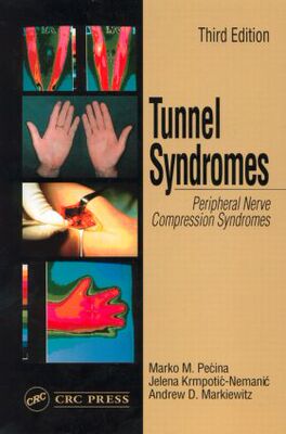 【预订】Tunnel Syndromes