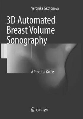 预订 3D Automated Breast Volume Sonography