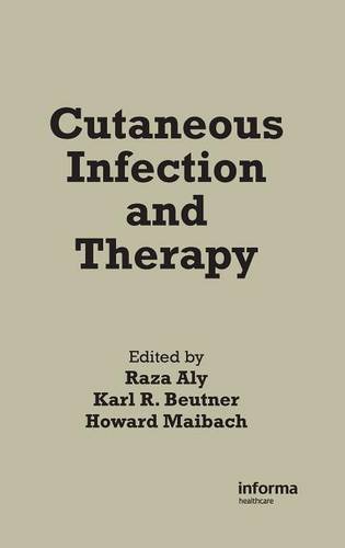 【预订】Cutaneous Infection and Therapy