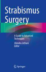 [预订]Strabismus Surgery
