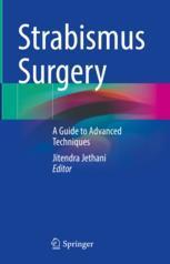 [预订]Strabismus Surgery