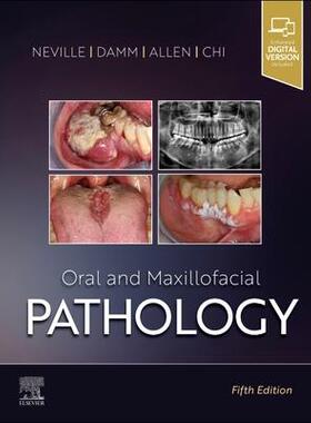 预订 Oral and Maxillofacial Pathology 9780323789813
