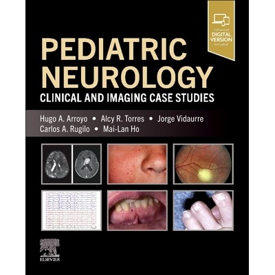 预订 Pediatric Neurology Clinical and Imaging Case Studies 小儿神经病学:临床和影像学案例研究 9780443287220