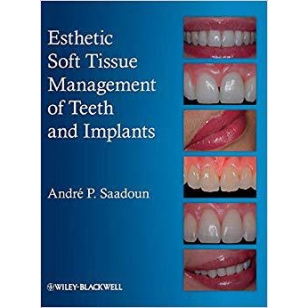 预订 Esthetic Soft Tissue Management of Teeth and Implants 牙齿和植入物的审美软组织管理: 9781118301159