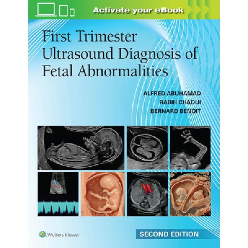 预订 First Trimester Ultrasound Diagnosis of Fetal Abnormalities 早孕期胎儿畸形超声诊断 9781975242831