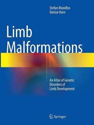 【预订】Limb Malformations