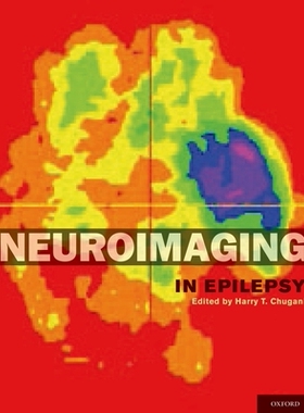 预订 Neuroimaging in Epilepsy