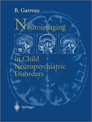 【预订】Neuroimaging in child neuropsychiatric disorders