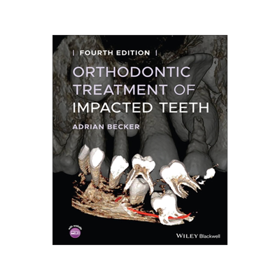 [预订]Orthodontic Treatment of Impacted Teeth 4/e