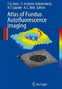 【预订】Atlas of Fundus Autofluorescence Imaging