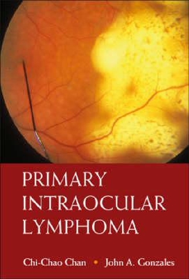 【预订】Primary Intraocular Lymphoma