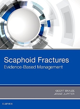 【预订】Scaphoid Fractures