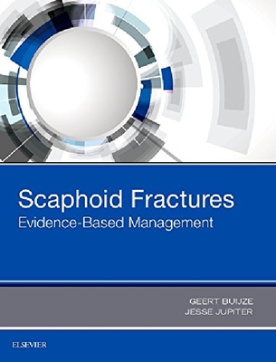 【预订】Scaphoid Fractures