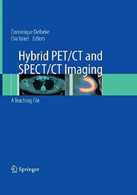 【预订】Hybrid PET/CT and SPECT/CT Imaging: ...