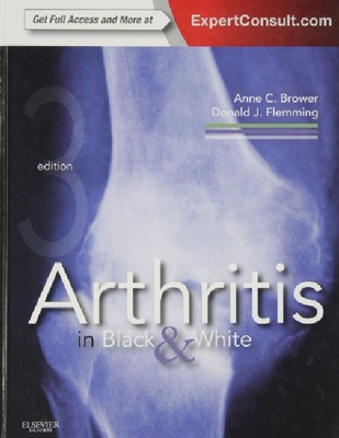 【预订】Arthritis in Black and White