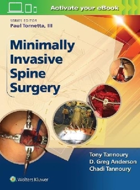 【预订】Minimally Invasive Spine Surgery