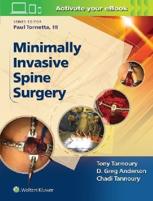 【预订】Minimally Invasive Spine Surgery