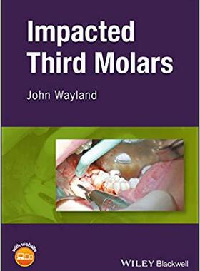 【预售】Impacted Third Molars