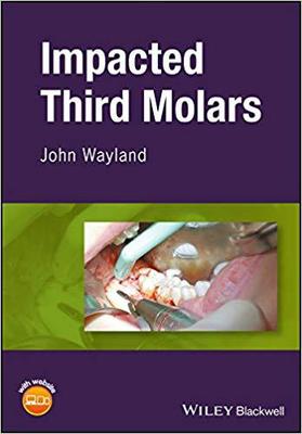 【预售】Impacted Third Molars