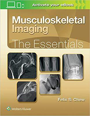 【预售】Musculoskeletal Imaging
