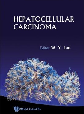 【预订】Hepatocellular Carcinoma