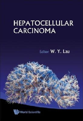 【预订】Hepatocellular Carcinoma