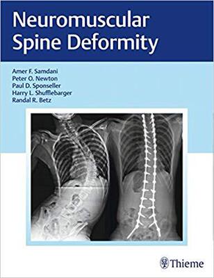 【预售】Neuromuscular Spine Deformity