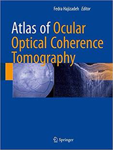 Atlas 预售 To... Optical Coherence Ocular