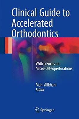 【预订】Clinical Guide to Accelerated Orthod...