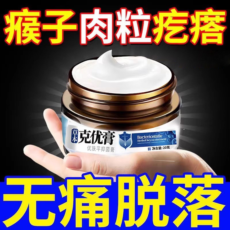 【轻松去掉】无忧去除猴子肉粒优体鸦胆子祛尤膏犹瘊偏方点尤药水