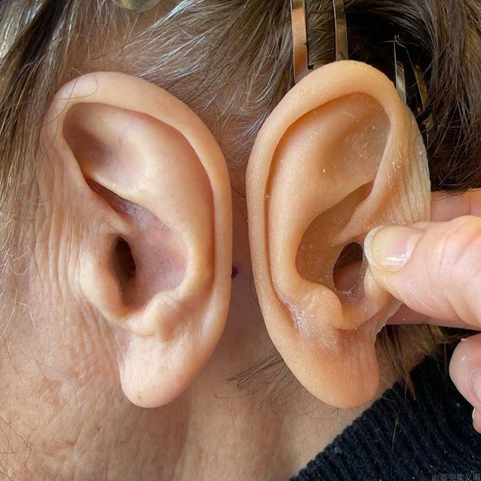 义耳定做仿真耳朵硅胶逼真假肢残疾义耳定制小耳症美化鼻子耳套