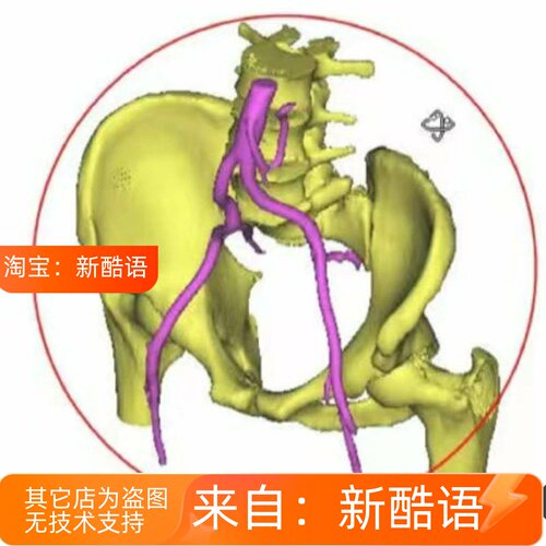 3matic mimics三维重构geomagic分析hypermesh仿真