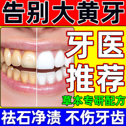 洁牙药水洗牙齿美白剂溶解污垢除牙石速效清理医用型牙黄变白神器