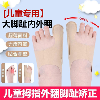 儿童脚趾拇指外翻矫正器拇外翻