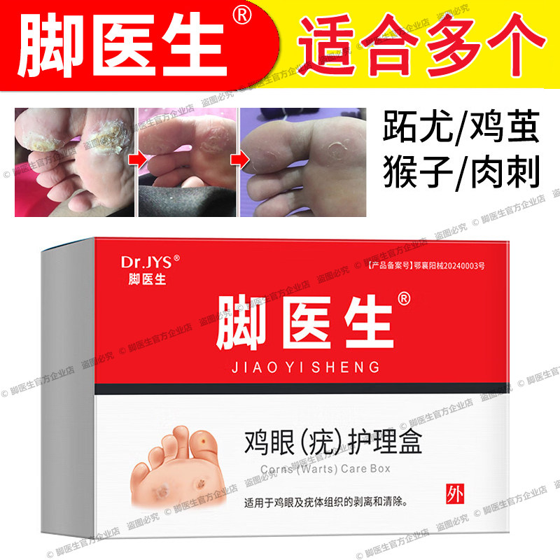 脚医生止尤净足部脚底上病毒疣鸡眼贴膏鸡尤净肉刺瘊子跖疣康去除
