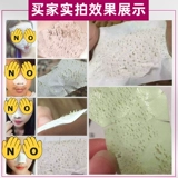 Отрывной гель алоэ вера от черных точек подходит для мужчин и женщин, носовые полоски, Таиланд