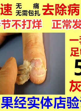 灰指甲专用液软甲膏脱甲膏去修刀亮甲日本疗治药水旗舰店正品