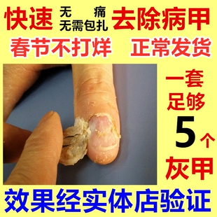 灰指甲专用液软甲膏脱甲膏去修刀亮甲日本疗治药水旗舰店正品