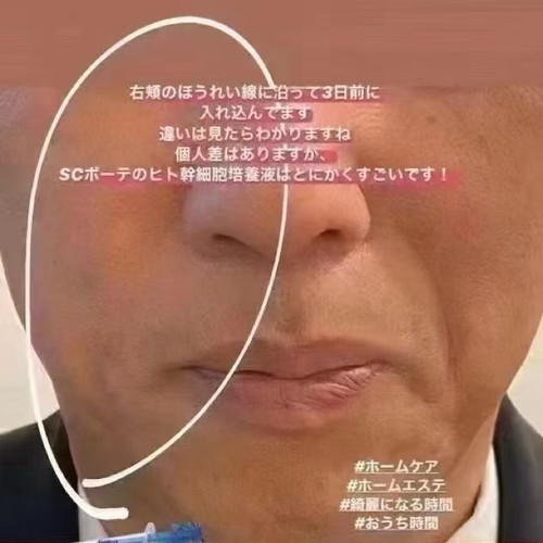 日本SC水光微针精华提拉保湿紧致