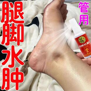 消肿去水肿专用老人脚肿消肿的药利尿排水肿小腿下肢浮肿特效喷剂